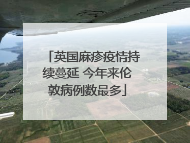 英国麻疹疫情持续蔓延 今年来伦敦病例数最多