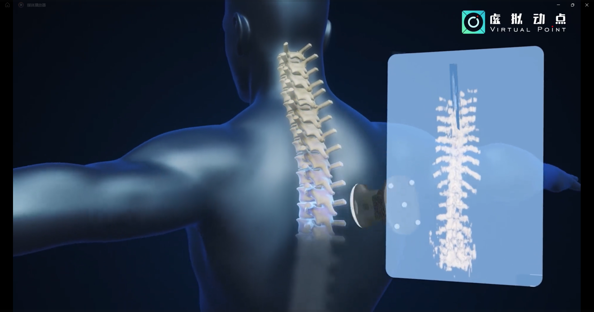 金沙990·虚拟动点OptiTrack开创3D超声成像在脊柱诊断中的应用